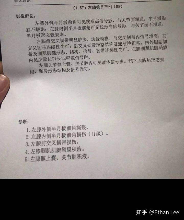 波尔津吉斯半月板撕裂，半月板后角退行性变撕裂